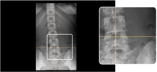 Chiro Axis line
