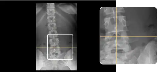 Chiro Axis line