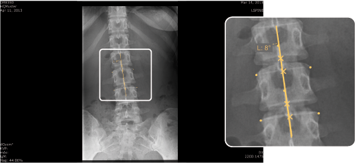Chiro Vertebrae line