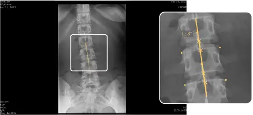 Chiro Vertebrae line