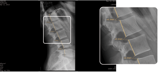 Chiro Georges line