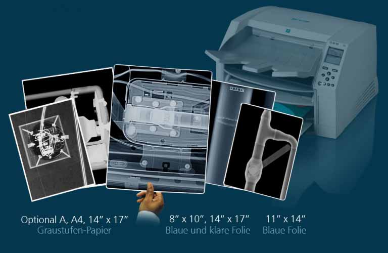 Desktop-Imager für Erstellung medizinischer Filme in diagnostischer Qualität sowie Graustufen-Papierdrucke