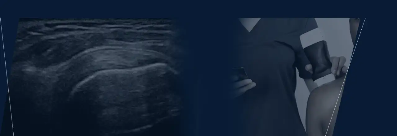 Wireless linear ultrasound scanner for human medicine