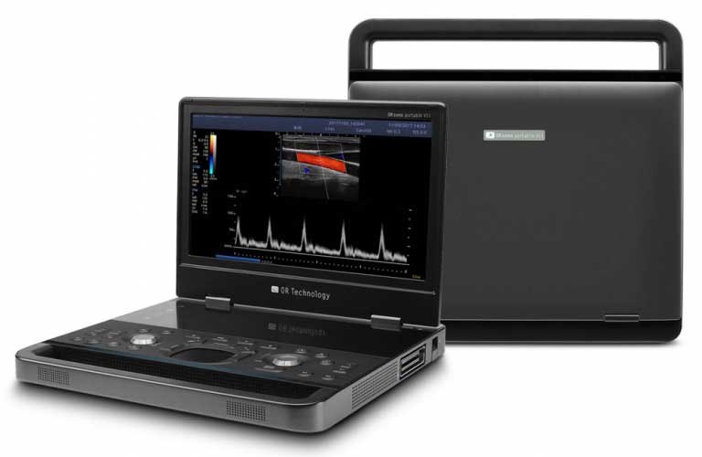 Portable ultrasound system for veterinarians - OR sono portable V11
