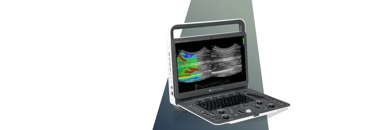 images/Produkte/Sonography/v2/sldr-sonography-system-or-sono-portable-v2-front.webp