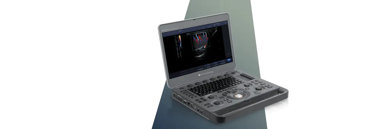 images/Produkte/Sonography/v3/sldr-sonography-system-or-sono-portable-v3-front.webp