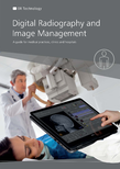 Digital X-ray in human medicine